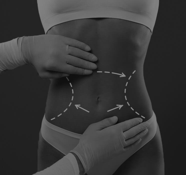 Body Contouring: Reshaping Your Silhouette Confident You